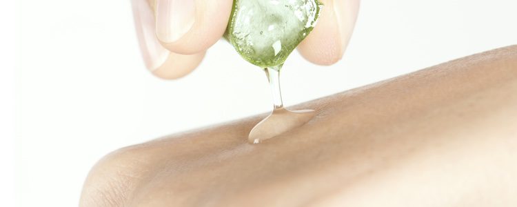 Si la quemadura es menor puedes utilizar aloe vera una vez se haya enfriado la piel