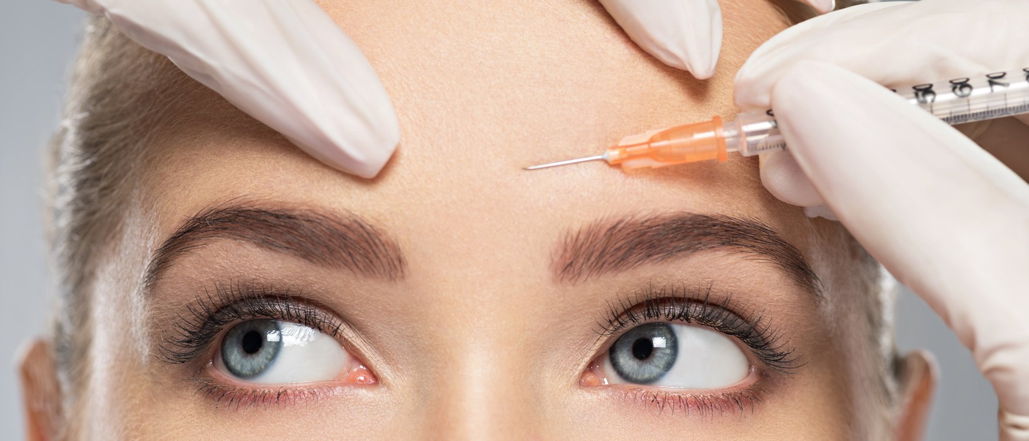 ¿En qué zonas se puede aplicar el botox?