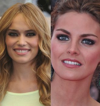 La sonrisa de las celebrities: el antes y el después tras su paso por el dentista