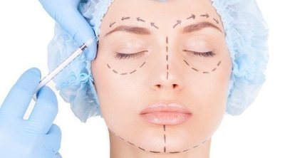 ¿En qué zonas se puede aplicar el botox?