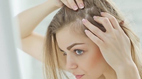 Alopecia femenina: mitos y realidades