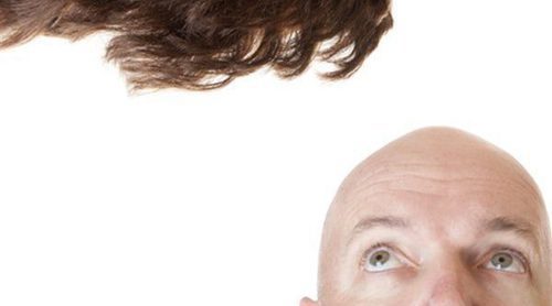 Peluquín: la alternativa para la alopecia