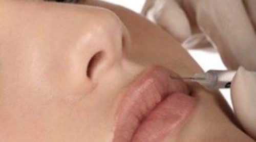 Hidratación y aumento de labios mediante una opción natural y segura