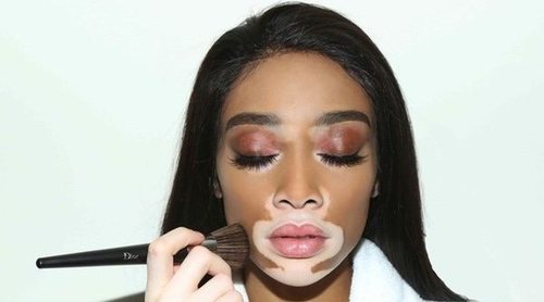 Kim Kardashian anuncia que para su nueva colección de maquillaje contará con Winnie Harlow