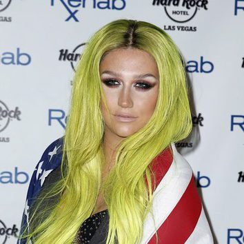 Kesha se pasa con el amarillo y con las raíces